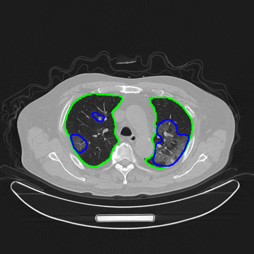 20200222112715523.png 1125610314_15823392625671n.png