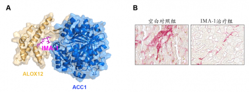  十年磨一劍 李紅良教授團(tuán)隊(duì)研發(fā)非酒精性脂肪肝炎全新治療藥物