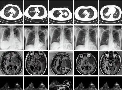 我國科學(xué)家建立生成式模型為醫(yī)學(xué)AI訓(xùn)練提供技術(shù)支持