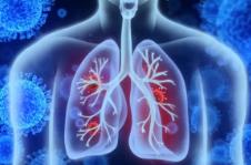 冬季急性呼吸道感染病例增加世衛(wèi)組織認為“趨勢未超預期”