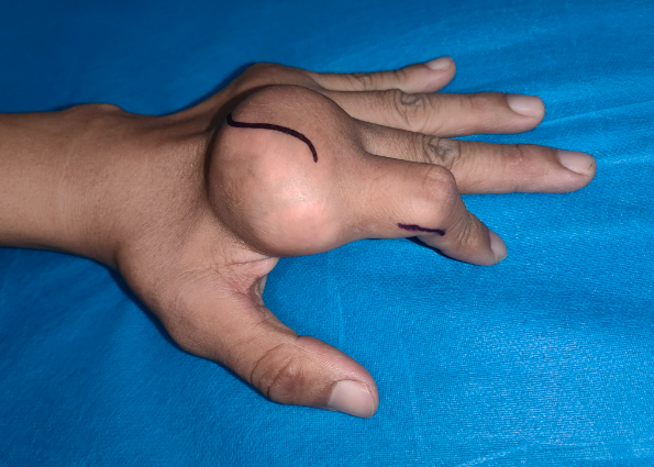 20250214164915418.png 20250214164915418.png