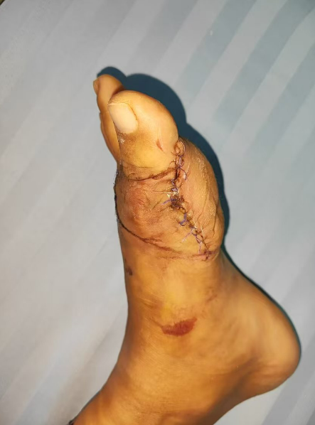 20250214165157565.png 20250214165157565.png