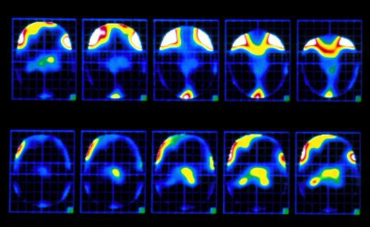 中國科學(xué)家實(shí)現(xiàn)1.36公里外毫米級高分辨成像技術(shù)