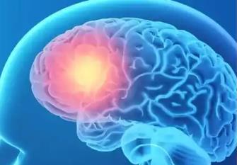 大規(guī)模臨床試驗(yàn)證實(shí)：低風(fēng)險(xiǎn)卒中患者監(jiān)測頻率可減半至17次