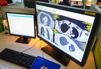 先行先試！5省份醫(yī)保影像云索引數(shù)據(jù)歸集364萬條