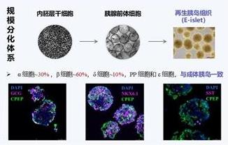 我國團隊推出再生胰島微創(chuàng)移植