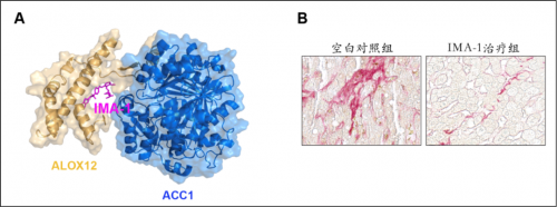  2021碩果累累 李紅良教授團隊在心血管代謝性疾病等領域連續(xù)取得重要進展