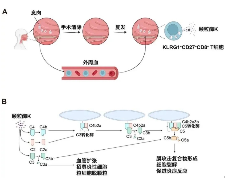 清華大學與北京同仁醫(yī)院團隊發(fā)表研究 揭示慢性鼻病復發(fā)關鍵機制
